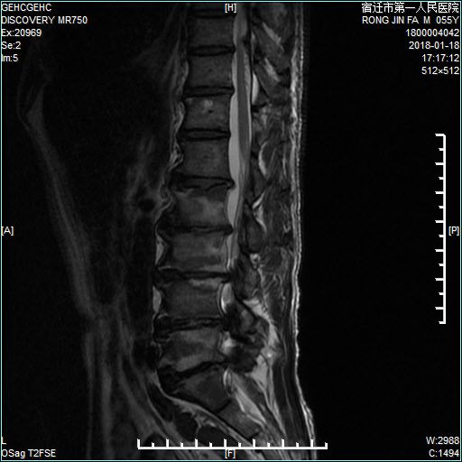 兄弟出头天 产品主图