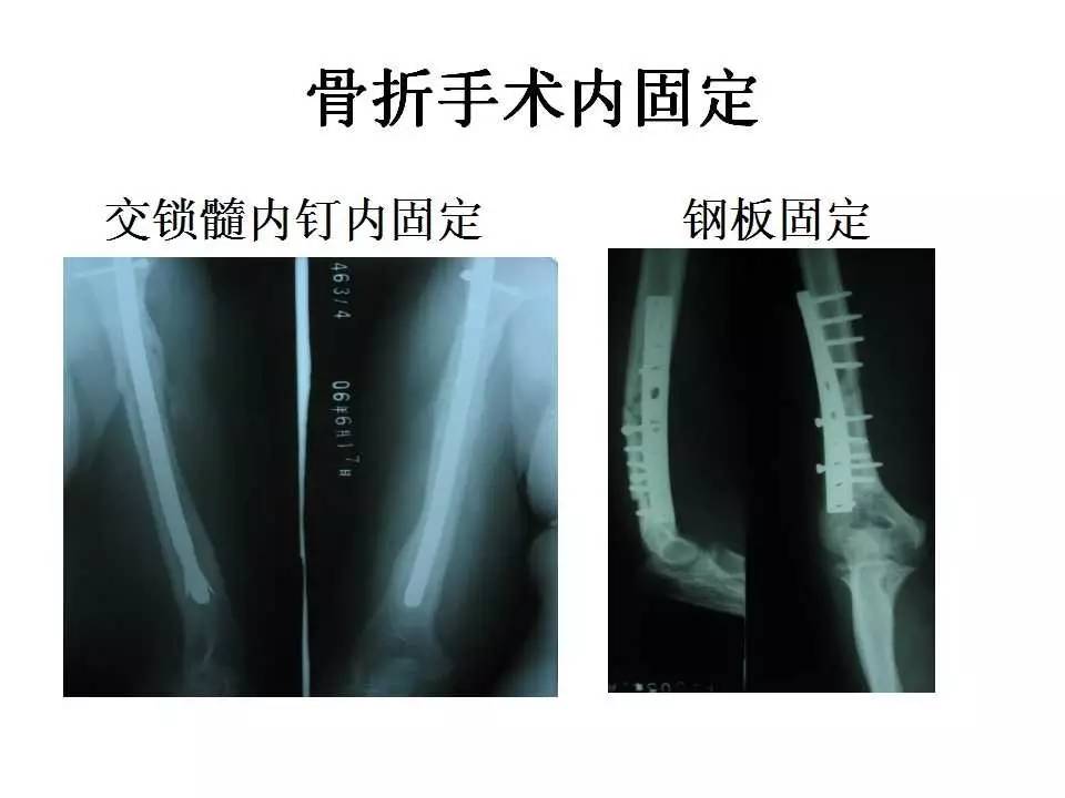 何二狗的名单 产品图片