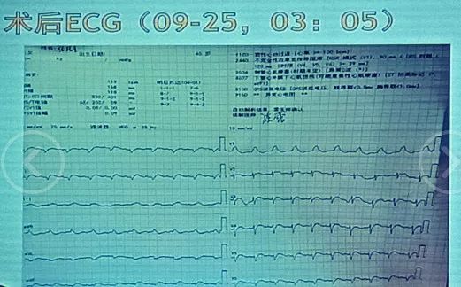 冰肤传说 相关产品
